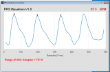 ppg_waveform2